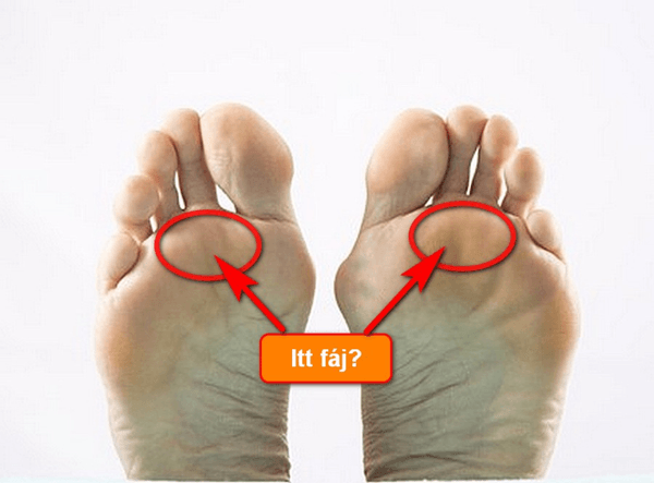 Fájdalmas pontok a lábon