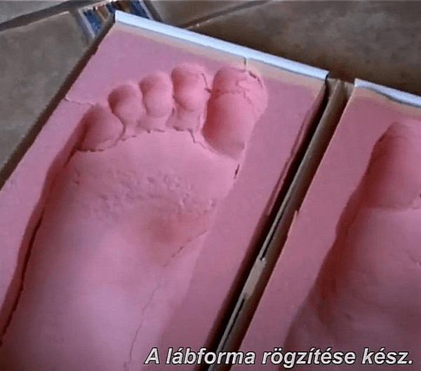 Lábtartás mérés monitoron